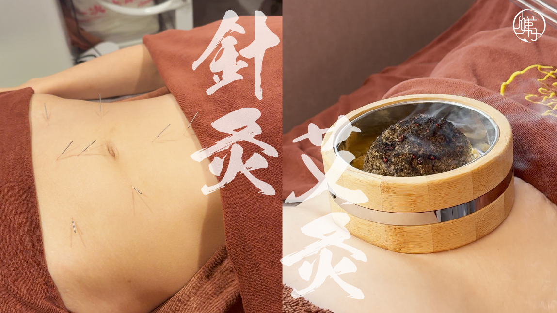 雁月中醫針灸與艾灸溫經調理