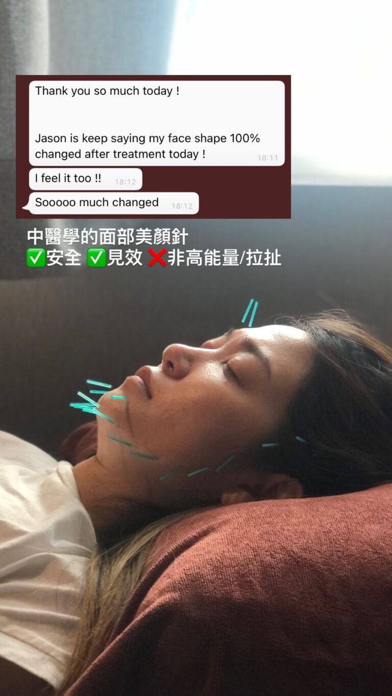 大J老婆Mia美顏針好評