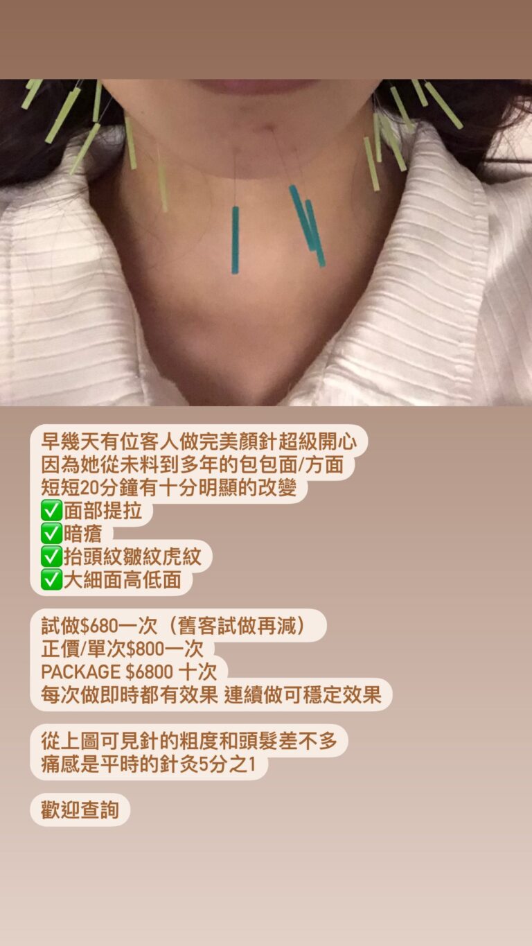 大J老婆Mia美顏針好評